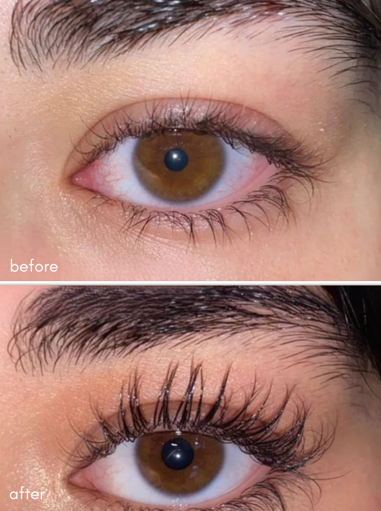 Eyelash Serum