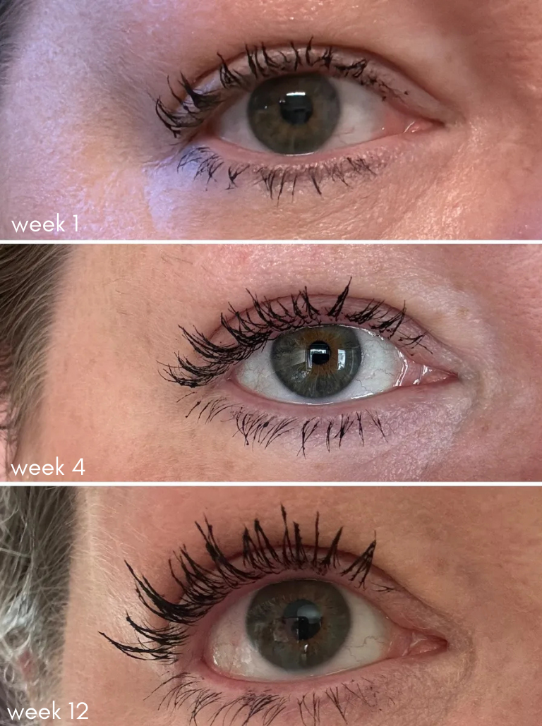 Eyelash Serum