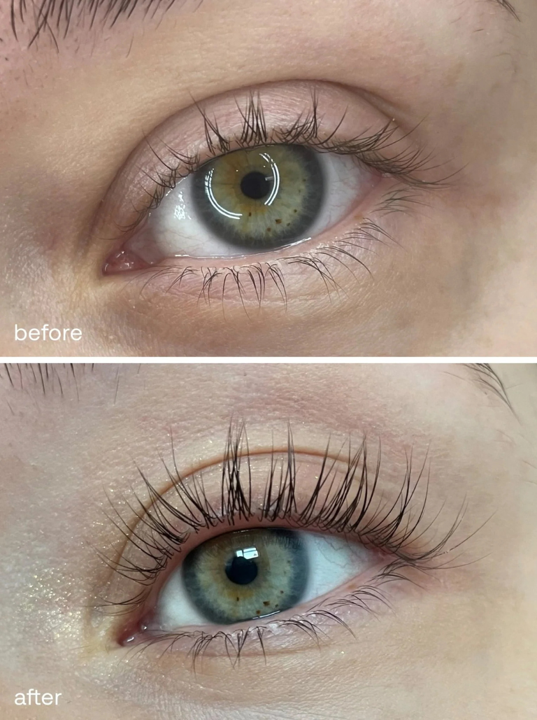 Eyelash Serum